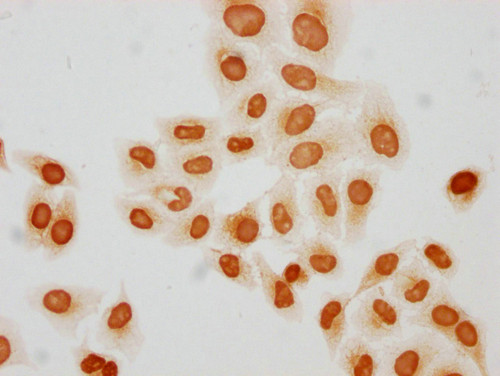 H4K31but Antibody in Immunocytochemistry (ICC/IF)