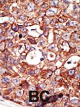 ZMPSTE24 Antibody in Immunohistochemistry (Paraffin) (IHC (P))