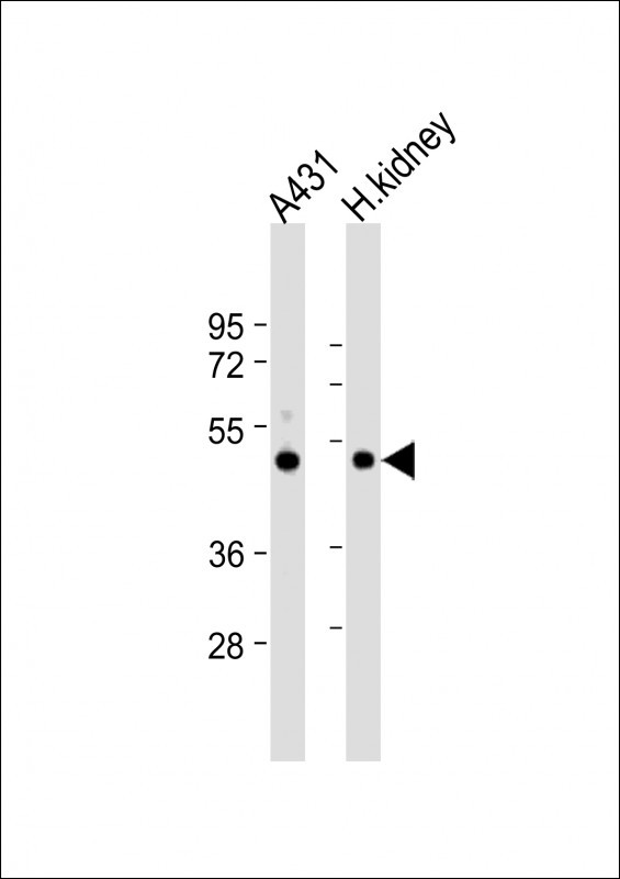 ZMPSTE24 Antibody in Western Blot (WB)