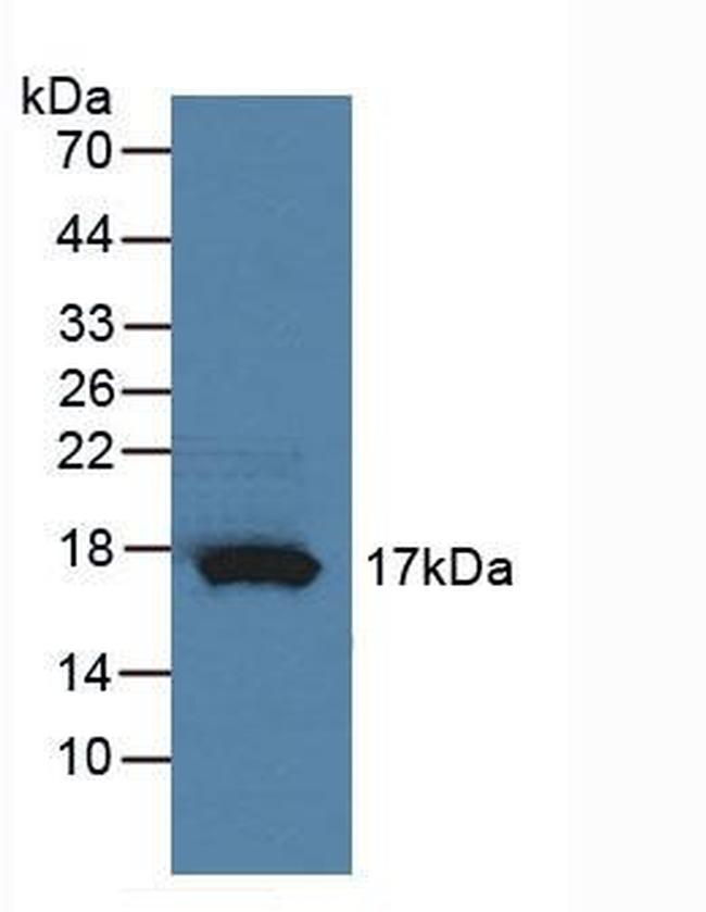RNASE4 Antibody in Western Blot (WB)