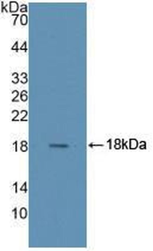 RNASE4 Antibody in Western Blot (WB)