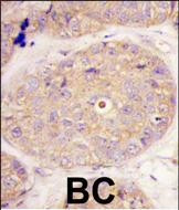 GGPS1 Antibody in Immunohistochemistry (Paraffin) (IHC (P))