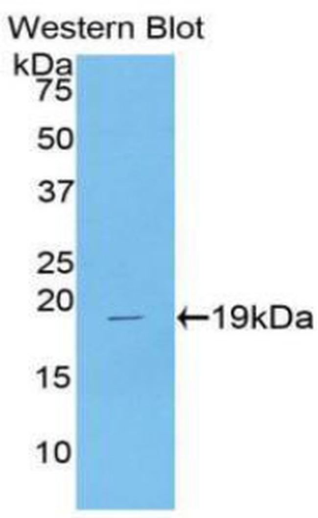 G-CSF Antibody in Western Blot (WB)