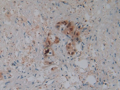 beta-2 Defensin Antibody in Immunohistochemistry (Paraffin) (IHC (P))