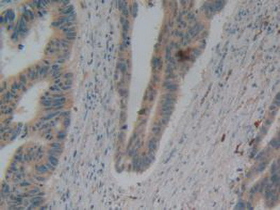 beta-2 Defensin Antibody in Immunohistochemistry (Paraffin) (IHC (P))