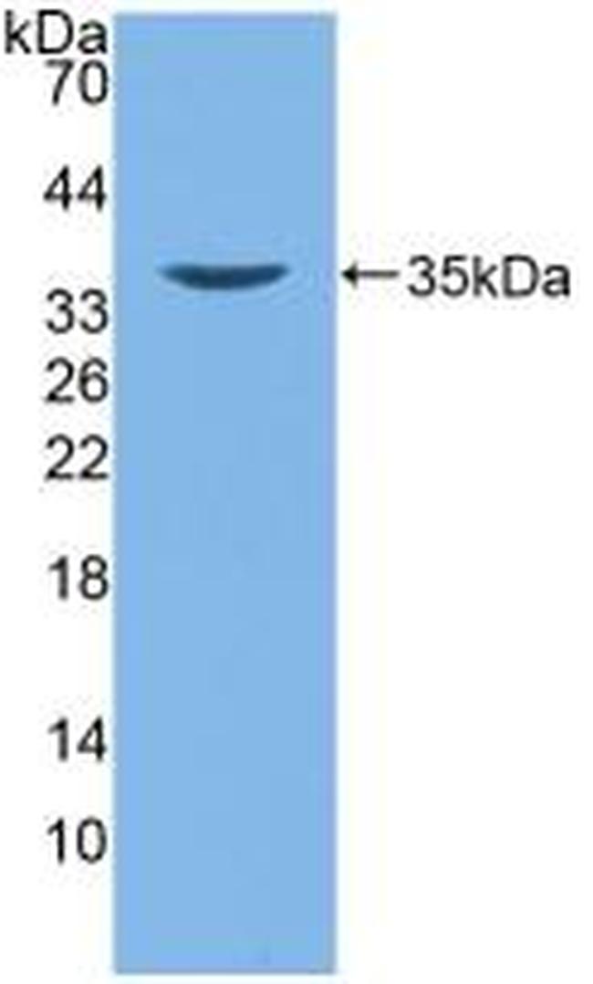 beta-2 Defensin Antibody in Western Blot (WB)