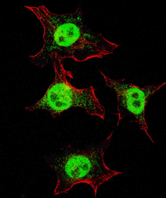 CD49f Antibody in Immunocytochemistry (ICC/IF)