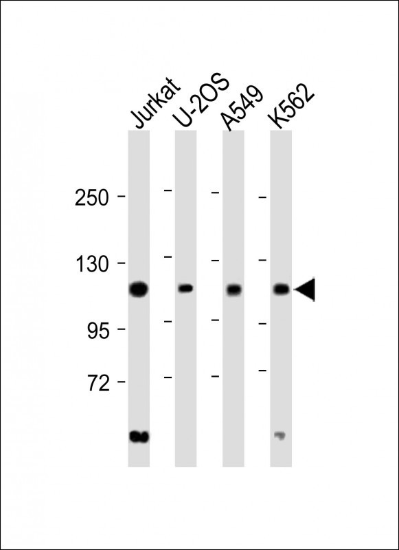 EXO1 Antibody in Western Blot (WB)