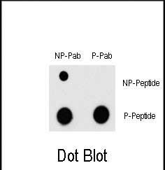 Phospho-MEF2C (Thr300) Antibody in Dot Blot (DB)