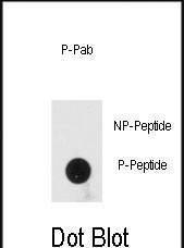 Phospho-PACT (Ser246) Antibody in Dot Blot (DB)