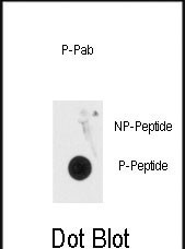 Phospho-MECP2 (Ser80) Antibody in Dot Blot (DB)