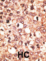 CRY1 Antibody in Immunohistochemistry (Paraffin) (IHC (P))