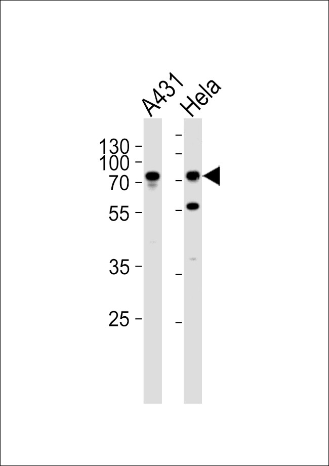 Septin-9 Antibody in Western Blot (WB)