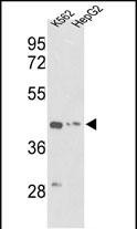 gamma Actin Antibody in Western Blot (WB)