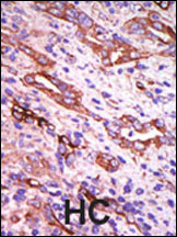 GRK1 Antibody in Immunohistochemistry (Paraffin) (IHC (P))