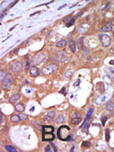 PKC mu Antibody in Immunohistochemistry (Paraffin) (IHC (P))