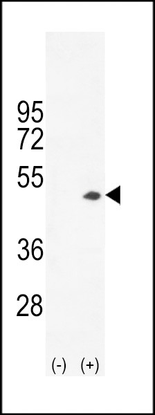 Creatine Kinase BB Antibody in Western Blot (WB)