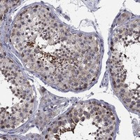 CNOT11 Antibody in Immunohistochemistry (Paraffin) (IHC (P))