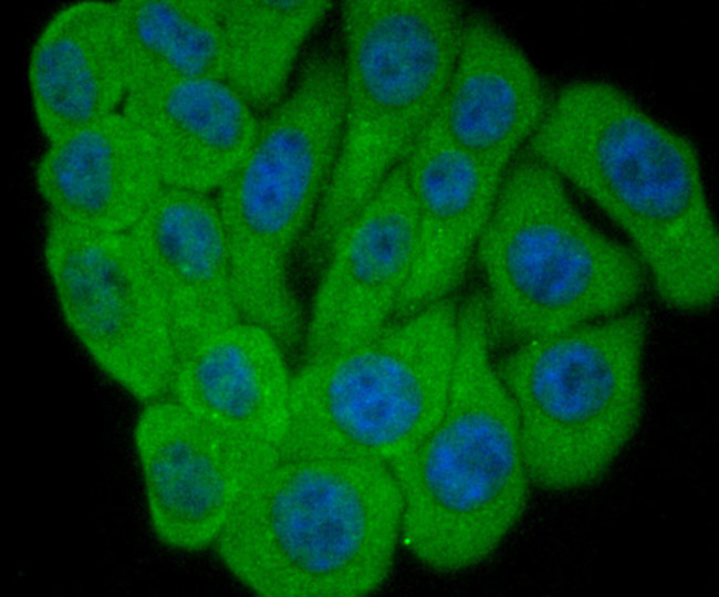 ALDH1A1 Antibody in Immunocytochemistry (ICC/IF)