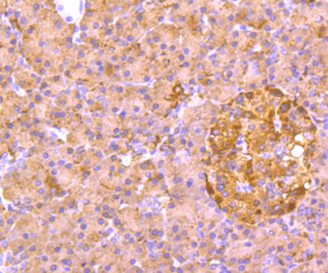 ALDH1A1 Antibody in Immunohistochemistry (Paraffin) (IHC (P))