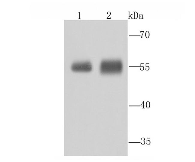 ALDH1A1 Antibody in Western Blot (WB)