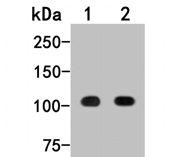 beta-1,2 Adaptin Antibody in Western Blot (WB)