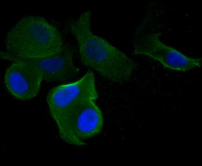 Cytokeratin 19 Antibody in Immunocytochemistry (ICC/IF)