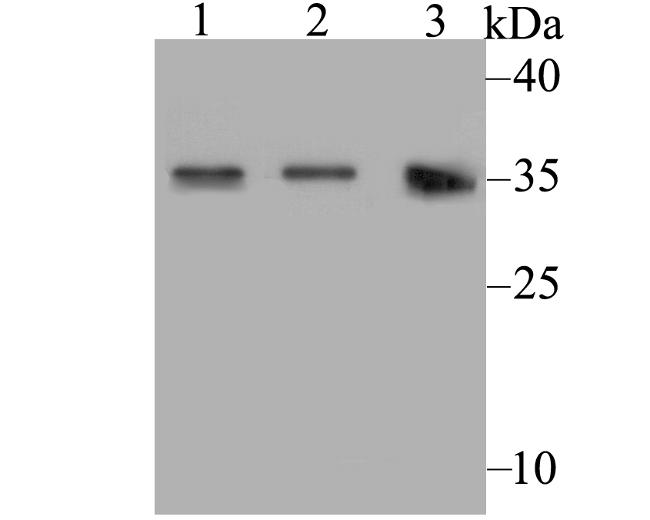 Connexin 32 Antibody in Western Blot (WB)