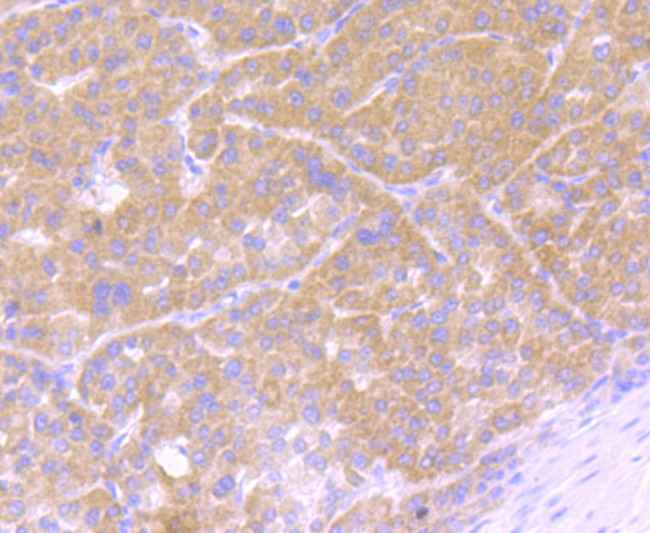 Osteopontin Antibody in Immunohistochemistry (Paraffin) (IHC (P))