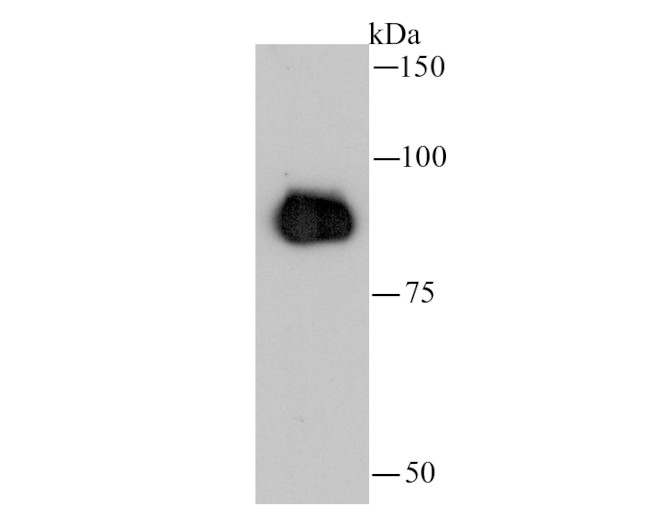 beta Catenin Antibody in Immunocytochemistry (ICC/IF)