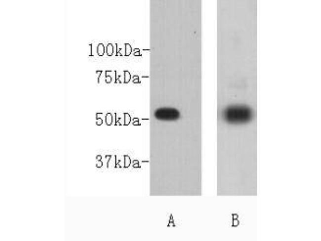 CD271 (NGF Receptor) Antibody in Western Blot (WB)