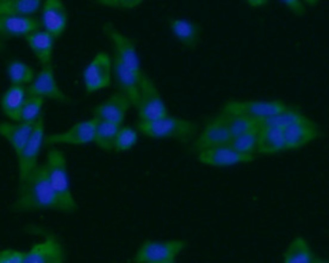 ARF1 Antibody in Immunocytochemistry (ICC/IF)