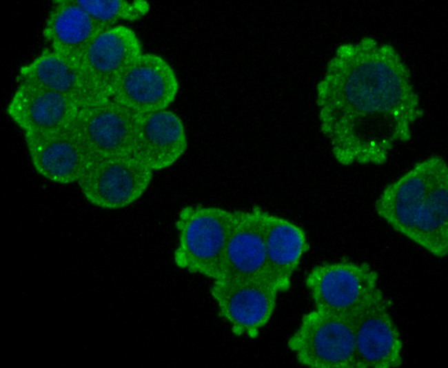 CD3 zeta (CD247) Antibody in Immunocytochemistry (ICC/IF)