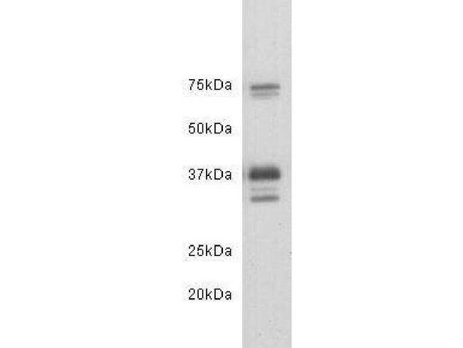 CD24 Polyclonal Antibody (PA5-141185)