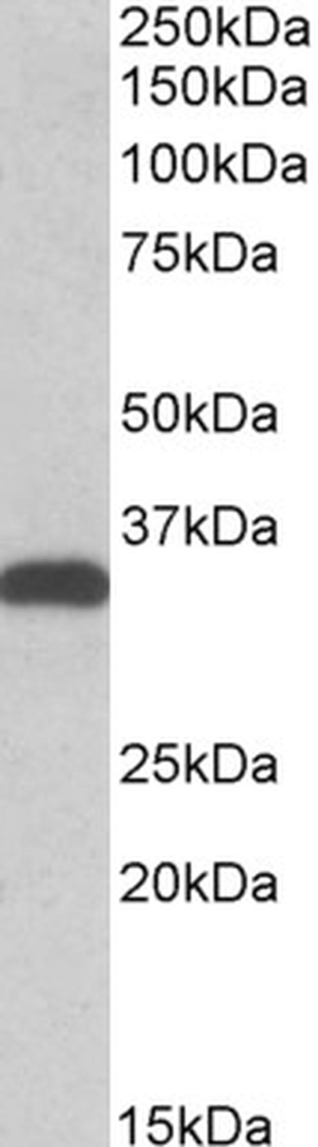 CBR3 Antibody in Western Blot (WB)