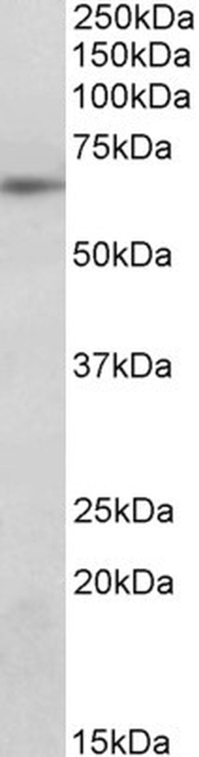 SOCS5 Antibody in Western Blot (WB)