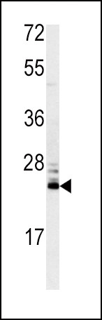 MSRA Antibody in Western Blot (WB)