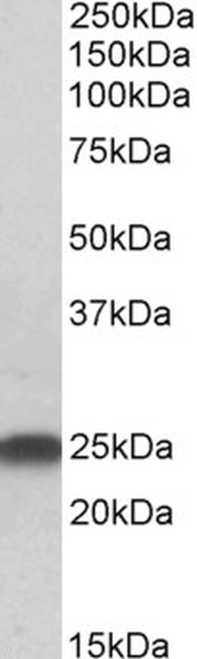 LIN7B Antibody in Western Blot (WB)