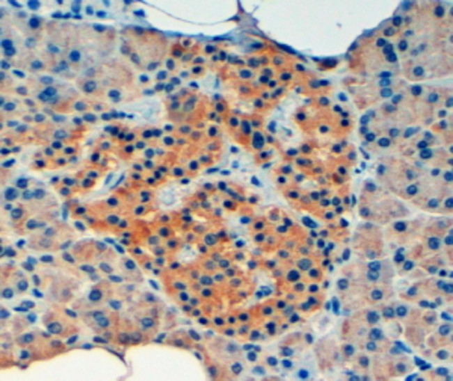 VPS11 Antibody in Immunohistochemistry (Paraffin) (IHC (P))