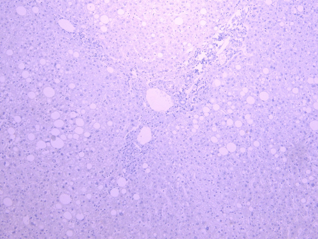 CYP3A4 Antibody in Immunohistochemistry (Paraffin) (IHC (P))