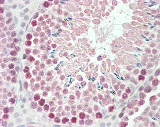 ROBO1 Antibody in Immunohistochemistry (Paraffin) (IHC (P))