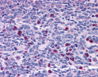 NAT10 Antibody in Immunohistochemistry (Paraffin) (IHC (P))