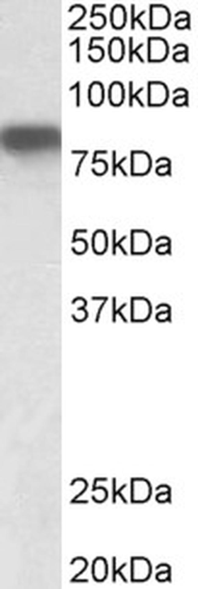 Hemopexin Antibody in Western Blot (WB)