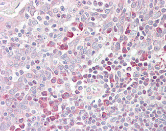 TEB4 Antibody in Immunohistochemistry (Paraffin) (IHC (P))