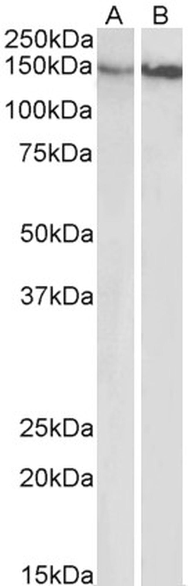 Integrin beta 1 (CD29) Antibody in Western Blot (WB)