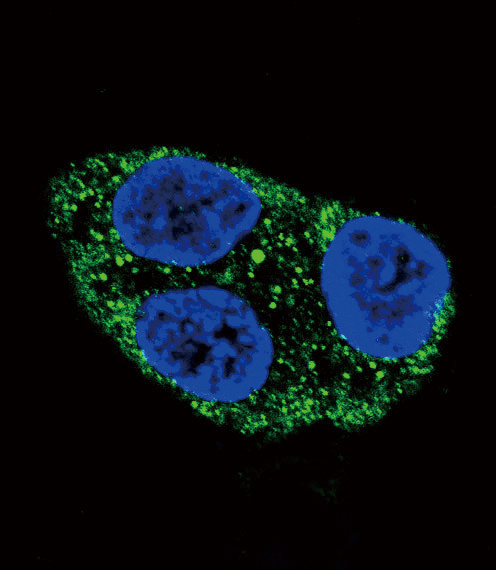 Tyrosinase Antibody in Immunocytochemistry (ICC/IF)