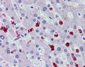 RASSF2 Antibody in Immunohistochemistry (Paraffin) (IHC (P))