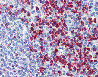 RASSF2 Antibody in Immunohistochemistry (Paraffin) (IHC (P))