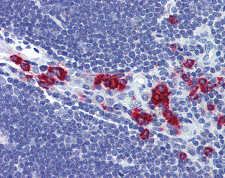 RASSF2 Antibody in Immunohistochemistry (Paraffin) (IHC (P))