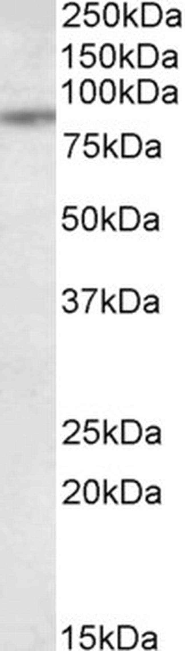 TAP1 Antibody in Western Blot (WB)